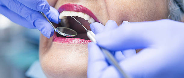 Best Emergency Tooth Extraction in Mountain Lakes, NJ
